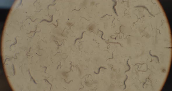 A Colony of Microorganisms, C-elegans Nematode Worms Under the Microscope, Macro