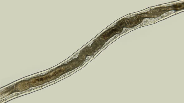 the Worm Enchytraeus Sp
