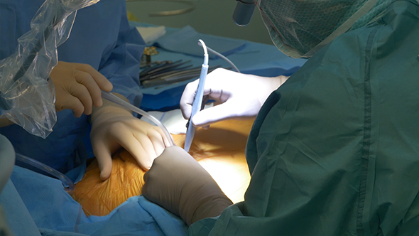 Surgeon Heart Operation