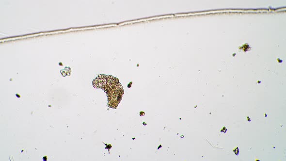Little Tardigrade is Moving It's Paws and Turning to the Side Under the Microscope