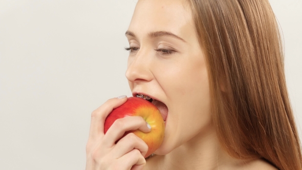 Blonde Girl With Braces Eating Apple. White. 