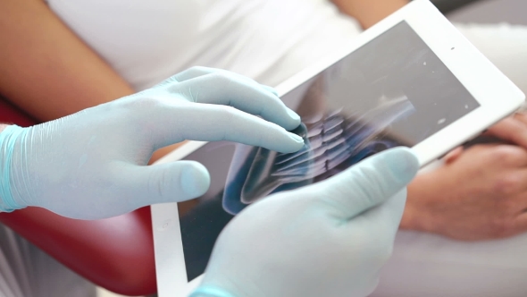 Dentist Or Intern Reviewing a Dental X-ray Explains What She Sees To a Patient