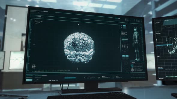 Human Patient Head Skull Scan By Advanced X-ray Screening Software Interface alt