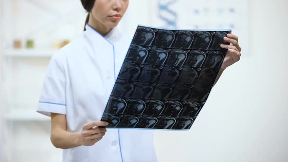 Female Doctor Looking at Knee Joint X-Ray, Good Examination Results, Medicine