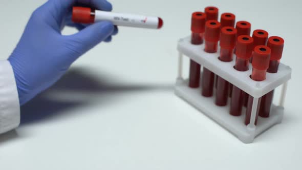 Positive HIV Test, Doctor Showing Blood Sample, Lab Research, Health Checkup