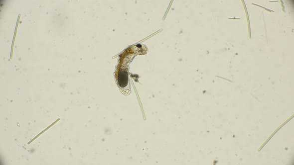 Rotifer Notommata Family Nototamidae  alt