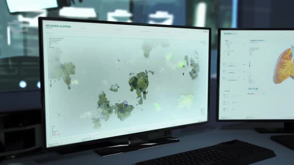 Systematic analysis of infusoria slippers bacteria structure at the laboratory alt