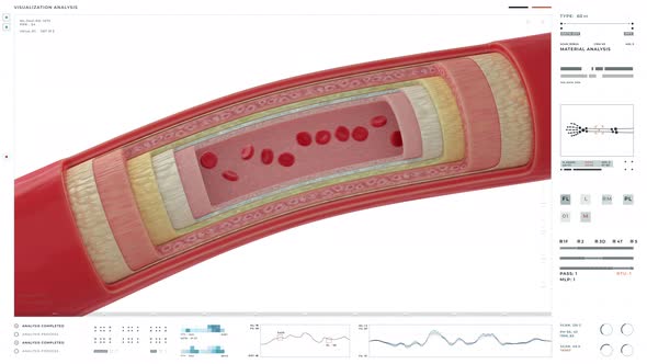 Interface of the health analysis system examining the arteries at the laboratory alt