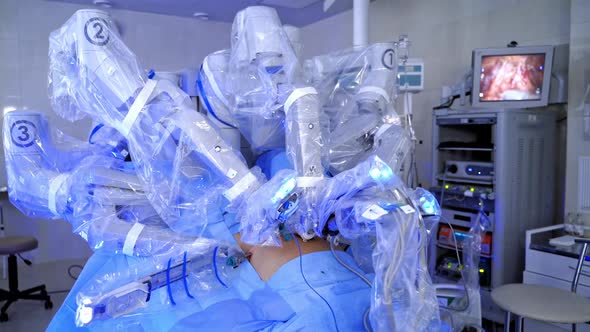 Minimally invasive surgery. Medical robot performing an operation to a patient.