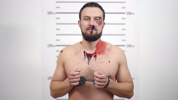 In Police Station Arrested Man with Wounded Face Getting Front-view Mug Shot