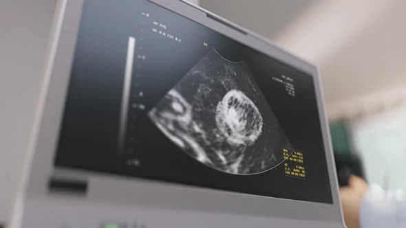 Ultrasonic test is investigating the conditions of the fetus at the hospital