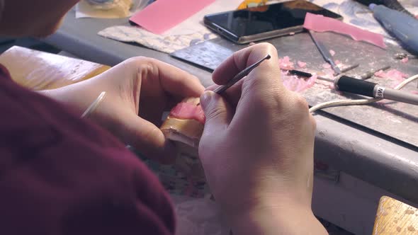 an Implantologist Performs Cleaning of a Denture