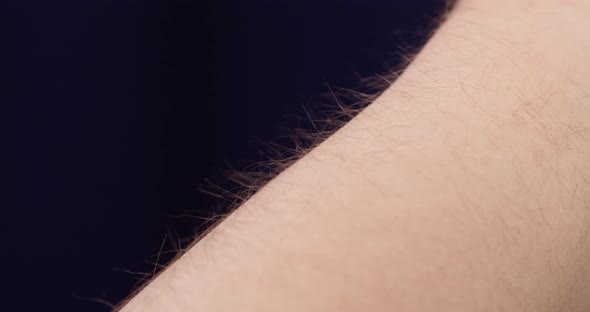 Human Hand with Goosebumps Closeup