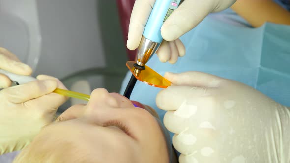 Health Concept. Boy at Dental Clinic Gets Dental Treatment To Fill a Cavity in Tooth. Top View