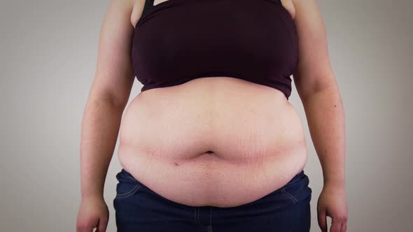 Close-up of Unrecognizable Caucasian Woman's Tummy. Obese Adult Woman Shaking Fat on Belly