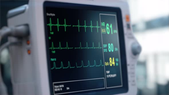 Heart Rate Monitor in Hospital Theater. Medical Vital Signs Monitor Instrument in a Hospital on