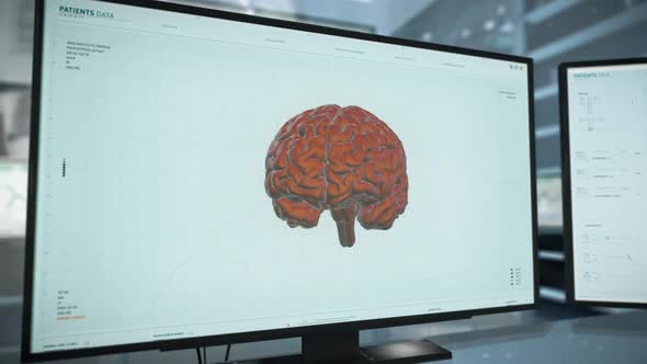 Medical organ scanning system has found dangerous tumor inside of a human brain alt