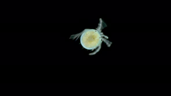 Female water mite Hydrachnidia, genus Arrenurus sp. under microscope, Order Trombidiformes