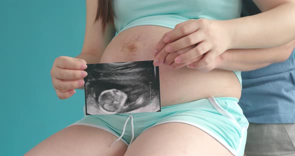 Pregnant woman holding ultrasound baby image in front of her belly 