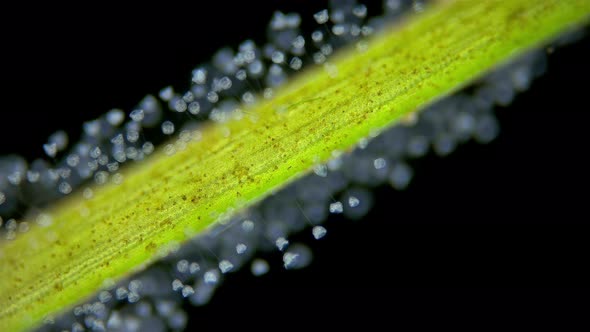 Infusoria Ciliophora Vorticella Under Microscope Class Oligohymenophorea