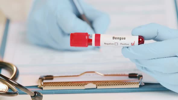 Doctor Holds in Hand Laboratory Positive Blood Test Tube for the Dengue Fever