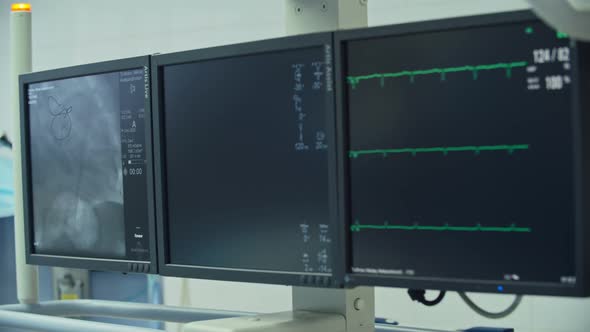 Monitors in Operating Room