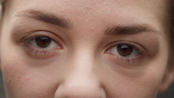 Closeup of a Browneyed Young Woman Wearing the Contact Lenses and Blinking Opening Eyes