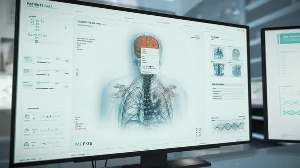 Diagnostic Medical Scanning Device During Laboratory Radiology Analysis alt