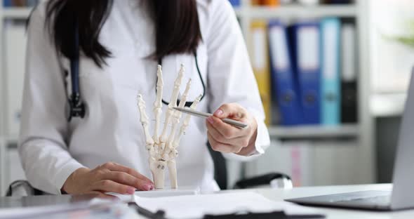 Doctor Surgeon Shows Model of Skeleton of Hands in Clinic