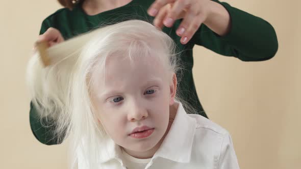 Charming Little Model Albino Is Preparing for a Photo in the Studio