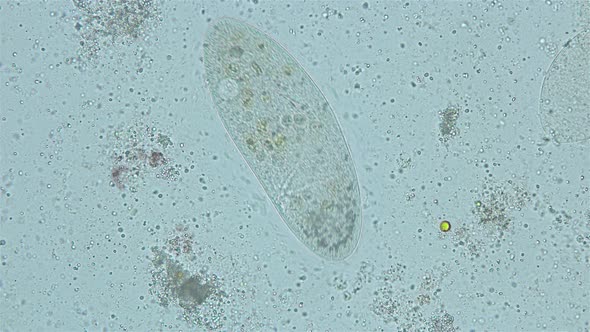 infusorium Ciliophora of the genus Paramecium under a microscope, order Peniculida