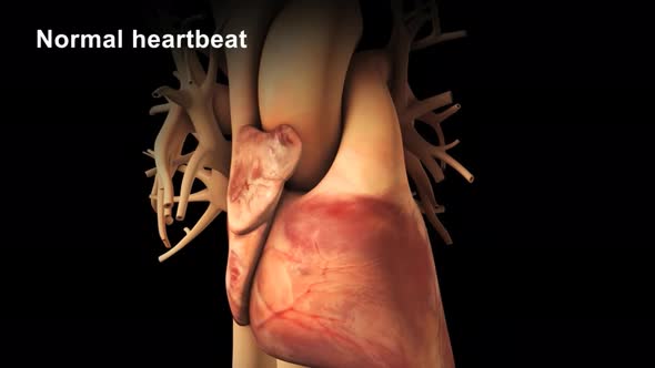 Bradycardia: This means a slow heartbeat - resting heart rate of less than 60 beats per minute