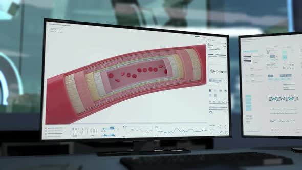 Medical software deals with the structural analysis of the blood in arteries alt