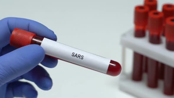 SARS, Laboratory Worker Holding Blood Sample in Tube Close-Up, Health Check-Up