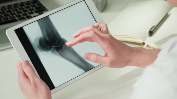 Doctor Veterinarian Examining Horse Hoof Skeleton Roentgen Closeup