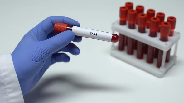 SARS Test, Doctor Showing Blood Sample in Tube, Lab Research, Health Checkup