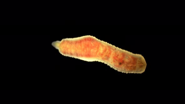 Oligochaeta Worm Under a Microscope, Type Annelida, Sample Found at Lake Baikal