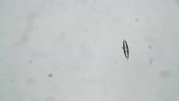 Diatoms Algae Cymbella Floating in Water on a White Background in a Microscope