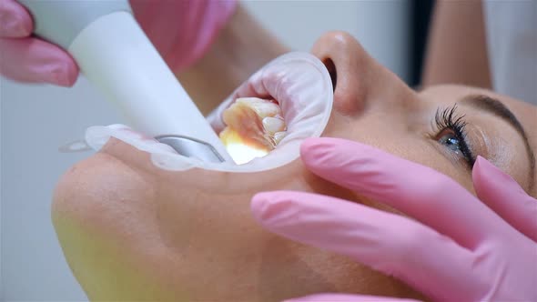 Dentist Scaning Patient's Teeth With Dental 3d Scanner And Screen With 3d Scanning Of Jaw.