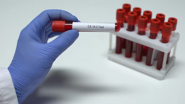 CA 15-3, Doctor Showing Blood Sample in Tube, Lab Research, Health Checkup
