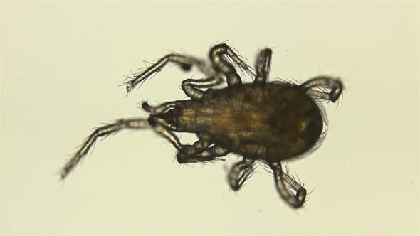 Acari(mite) Under a Microscope, Order of the Mesostigmata