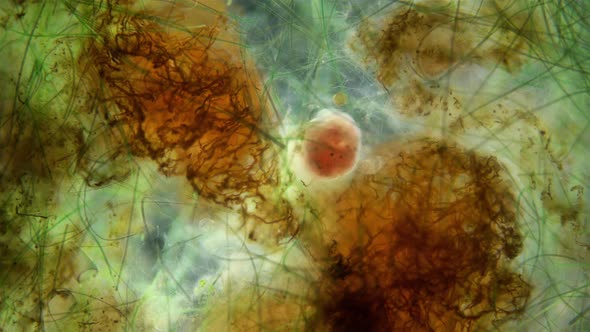 Infusoria Ciliophora Under the Microscope Alveolata Group