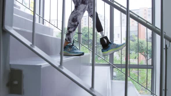 Woman with prosthetic leg at hospital