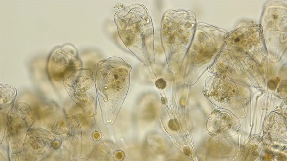 Infusoria Vorticella Under the Microscope, Class Oligohymenophorea.