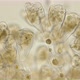 Infusoria Vorticella Under the Microscope, Class Oligohymenophorea. - VideoHive Item for Sale