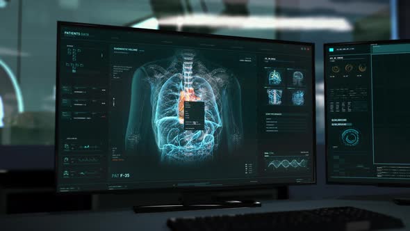 X-ray examination system identifies the dangerous cardiac ischemia illness alt