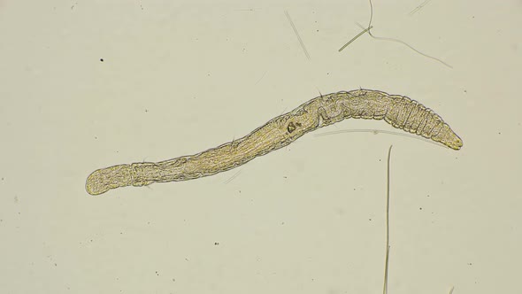 Worm of the Family Aeolosomatidae