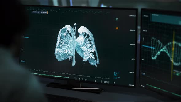 Doctor Uses Medical Analysis Interface To Diagnose Covid Virus Infecting Lungs