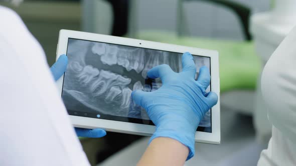 Dentist Looking at Human Teeth X-ray on the Digital Tablet.