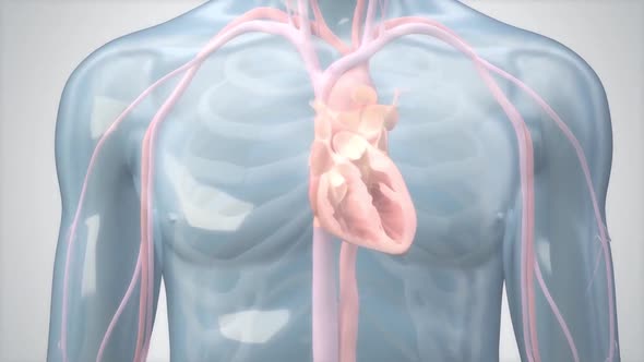 Stent Angioplasty Procedure 3d medical